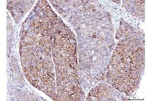 IHC analysis of Poliovirus Receptor/PVR using anti-Poliovirus Receptor/PVR antibody (ABIN7601071). (Poliovirus Receptor anticorps  (AA 28-331))