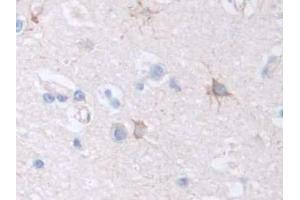 IHC-P analysis of Human Cerebrum Tissue, with DAB staining. (Factor VIII anticorps  (AA 1887-2044))