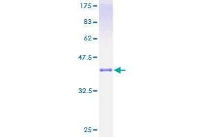 SDS-PAGE (SDS) image for Cystatin A (Stefin A) (CSTA) (AA 1-98) protein (GST tag) (ABIN1350599)