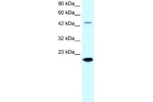 MMP19 antibody used at 5-10 ug/ml to detect target protein. (MMP19 anticorps  (C-Term))