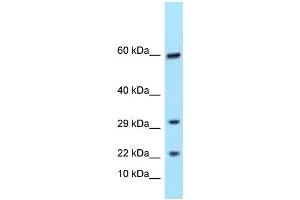Western Blotting (WB) image for anti-T Cell Receptor gamma Variable 9 (TRGV9) (C-Term) antibody (ABIN2788572) (TRGC1 anticorps  (C-Term))