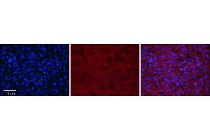Rabbit Anti-MASP2 Antibody      Formalin Fixed Paraffin Embedded Tissue: Human Adult Liver   Observed Staining: Cytoplasm in hepatocytes, weak signal, wide tissue distribution   Primary Antibody Concentration: 1:100  Secondary Antibody: Donkey anti-Rabbit-Cy3  Secondary Antibody Concentration: 1:200  Magnification: 20X  Exposure Time: 0. (MASP2 anticorps  (N-Term))