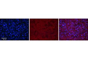 Rabbit Anti-MASP2 Antibody      Formalin Fixed Paraffin Embedded Tissue: Human Adult Liver   Observed Staining: Cytoplasm in hepatocytes, weak signal, wide tissue distribution   Primary Antibody Concentration: 1:100  Secondary Antibody: Donkey anti-Rabbit-Cy3  Secondary Antibody Concentration: 1:200  Magnification: 20X  Exposure Time: 0. (MASP2 anticorps  (N-Term))