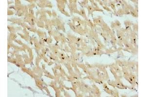 Immunohistochemistry of paraffin-embedded human heart tissue using ABIN7149013 at dilution of 1:100 (CSRP3 anticorps  (AA 1-194))