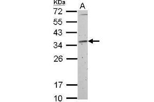 WB Image Fibrillarin antibody detects FBL protein by Western blot analysis.