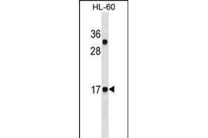 CALCA/CT Antibody ABIN1536608 western blot analysis in HL-60 cell line lysates (35 μg/lane). (Calcitonin anticorps  (AA 104-132))