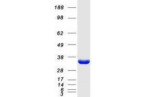 Validation with Western Blot