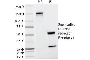 SDS-PAGE Analysis Purified TYRP1 Mouse Monoclonal Antibody (TA99). (Tyrosinase-Related Protein 1 anticorps)