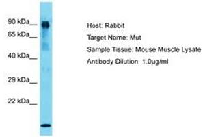 Image no. 1 for anti-Methylmalonyl Coenzyme A Mutase (MUT) (AA 44-93) antibody (ABIN6750352) (MUT anticorps  (AA 44-93))