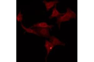 ABIN6276067 staining HuvEc by IF/ICC.