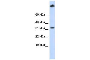 SCP2 antibody used at 1 ug/ml to detect target protein.