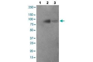 Western blot analysis of Lane 1: antigen-specific peptide treated JK cells, Lane 2: JK cells cells, Lane 3: COS-7 cells with FER (phospho Y402) polyclonal antibody  at 1:500-1:1000 dilution. (FER anticorps  (pTyr402))
