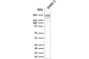 Western Blot Analysis of PANC-1 cell lysate using Spectrin beta III Monoclonal Antibody (SPTBN2/1584).