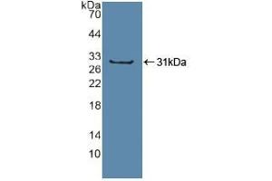 Western blot analysis of recombinant Human Sp100. (SP100 anticorps  (AA 610-802))