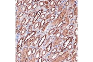 Immunohistochemistry of paraffin-embedded rat kidney using Carbonic Anhydrase 2 (C) Rabbit mAb (ABIN7266070) at dilution of 1:100 (40x lens). (CA2 anticorps)