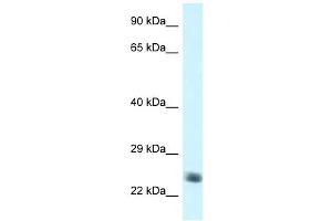 Western Blot showing NDUFS8 antibody used at a concentration of 1 ug/ml against Jurkat Cell Lysate (NDUFS8 anticorps  (C-Term))