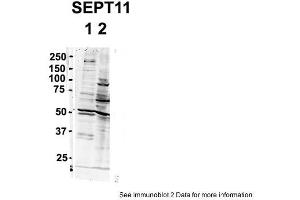 Sample Type: 1. (Septin 11 anticorps  (N-Term))
