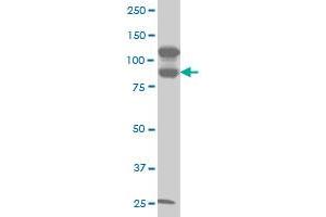 KSR2 monoclonal antibody (M06), clone 5E9 Western Blot analysis of KSR2 expression in A-431 . (KSR2 anticorps  (AA 411-500))