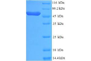 SDS-PAGE (SDS) image for Casein Kinase 1, epsilon (CSNK1E) (AA 1-416), (full length) protein (His tag) (ABIN5709343)