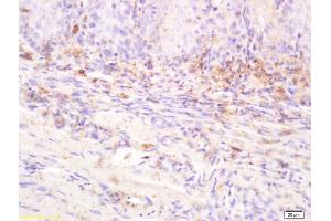 Formalin-fixed and paraffin embedded rat tongue labeled with Anti-IL-20R alpha/IL20RA Polyclonal Antibody, Unconjugated (ABIN748103) at 1:200 followed by conjugation to the secondary antibody