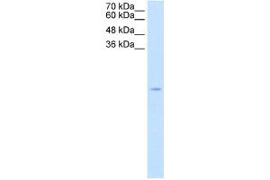 WB Suggested Antibody Titration:  2.