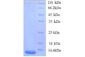 SDS-PAGE (SDS) image for Trefoil Factor 1 (TFF1) (AA 25-84) protein (His tag) (ABIN7478964) (TFF1 Protein (AA 25-84) (His tag))