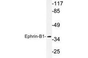 Western blot analysis of Ephrin-B1 antibody in extracts from COS7 cells. (Ephrin B1 anticorps)