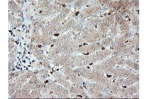 Image no. 12 for anti-SAM Domain and HD Domain 1 (SAMHD1) antibody (ABIN1500798)