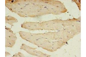 Immunohistochemistry of paraffin-embedded human skeletal muscle tissue using ABIN7145877 at dilution of 1:100