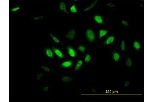 Immunofluorescence of monoclonal antibody to GPR135 on MCF-7 cell. (GPR135 anticorps  (AA 391-493))