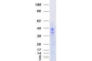 Validation with Western Blot