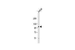 Western Blot at 1:1000 dilution + Jurkat whole cell lysate Lysates/proteins at 20 ug per lane. (Unc5c anticorps  (N-Term))
