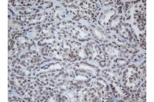 Image no. 3 for anti-Chromobox Homolog 8 (CBX8) (AA 1-260) antibody (ABIN1490663)