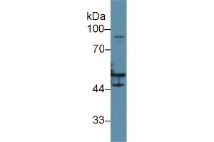 Western blot analysis of Human HeLa cell lysate, using Human KRT16 Antibody (2 µg/ml) and HRP-conjugated Goat Anti-Rabbit antibody ( (KRT16 anticorps  (AA 117-419))