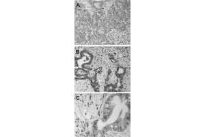 Immunohistochemistry of formalin-fixed paraffin-embedded human pancreas tissue sections. (BAG3 anticorps)