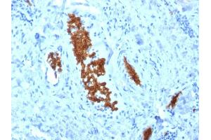 Formalin-fixed, paraffin-embedded human Tonsil stained with Spectrin alpha 1 (SPTA1) Mouse Monoclonal Antibody (SPTA1/1810).