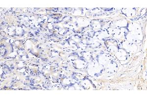 Detection of ELN in Human Stomach Tissue using Polyclonal Antibody to Elastin (ELN)