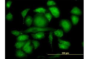 Immunofluorescence of monoclonal antibody to RDX on HeLa cell.
