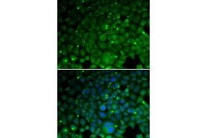 Immunofluorescence analysis of HeLa cell using CRYAA antibody. (CRYAA anticorps)