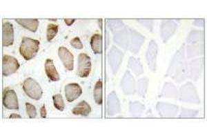 Immunohistochemistry analysis of paraffin-embedded human skeletal muscle using DUS2L antibody. (DUSL2 anticorps  (C-Term))