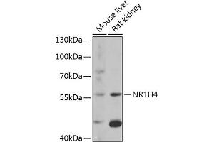 Western blot analysis of extracts of various cell lines, using NR1H4 antibody (ABIN6127919, ABIN6144801, ABIN6144803 and ABIN6216539) at 1:1000 dilution. (NR1H4 anticorps  (AA 207-476))