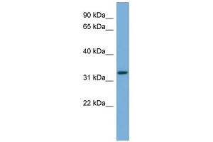 WB Suggested Anti-ATG3 Antibody Titration: 0.
