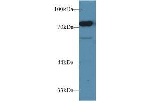 Detection of CD2AP in Rat Testis lysate using Polyclonal Antibody to CD2 Associated Protein (CD2AP) (CD2AP anticorps  (AA 368-623))