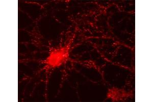 Indirect immunohystochemistry of a rat hippocampus section (dilution 1 : 500).