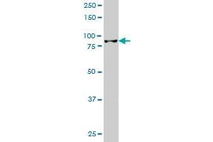 HIC1 monoclonal antibody (M02), clone 2F9 Western Blot analysis of HIC1 expression in Jurkat . (HIC1 anticorps  (AA 396-453))
