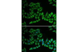 Immunofluorescence analysis of U2OS cells using TPMT antibody (ABIN5970397).