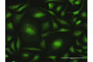 Immunofluorescence of purified MaxPab antibody to CALML6 on HeLa cell. (CALML6 anticorps  (AA 1-181))