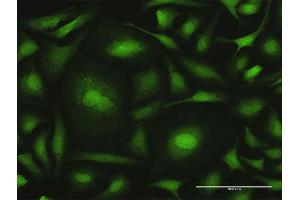 Immunofluorescence of purified MaxPab antibody to CALML6 on HeLa cell. (CALML6 anticorps  (AA 1-181))