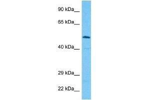 Host:  Rabbit  Target Name:  ALG9  Sample Type:  Jurkat Whole Cell lysates  Antibody Dilution:  1. (ALG9 anticorps  (Middle Region))