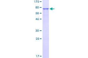 Image no. 1 for Craniofacial Development Protein 1 (CFDP1) (AA 1-299) protein (GST tag) (ABIN1349200)